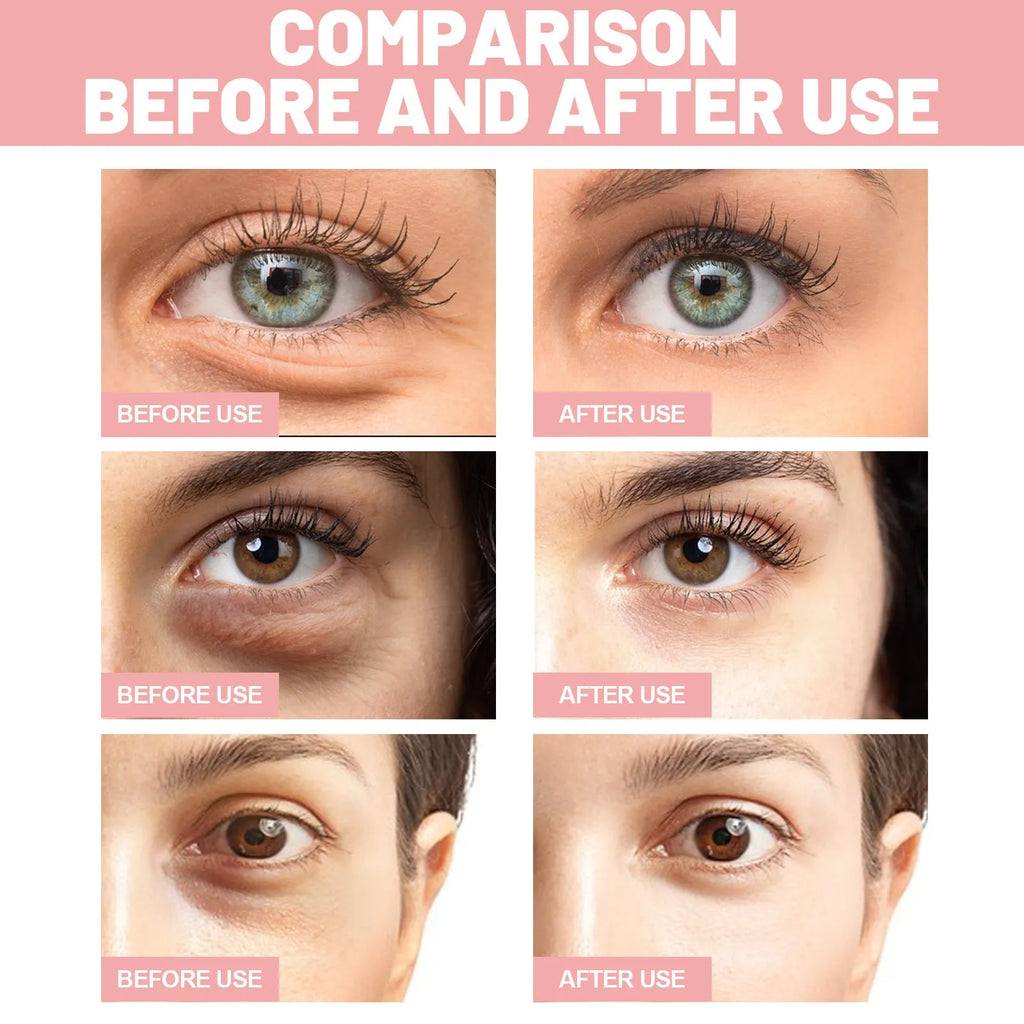 60 pairs of under eye patches with retinol and peptides for wrinkle fading and dark circles