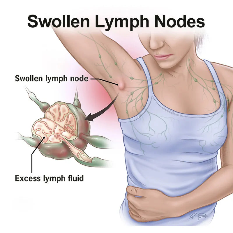 Neck lymphatic drainage patch adhesive sheet for lymph congestion relief and immunity support