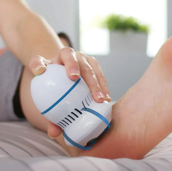 Beige and white electric foot file callus remover with two grinding heads and USB cable