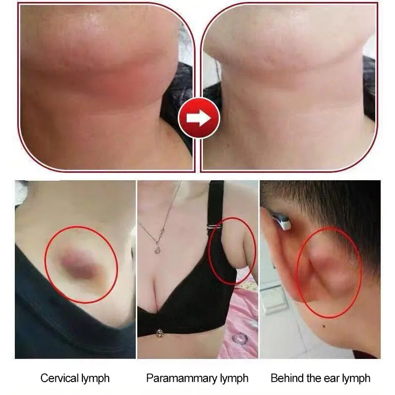 Neck lymphatic drainage patch adhesive sheet for lymph congestion relief and immunity support