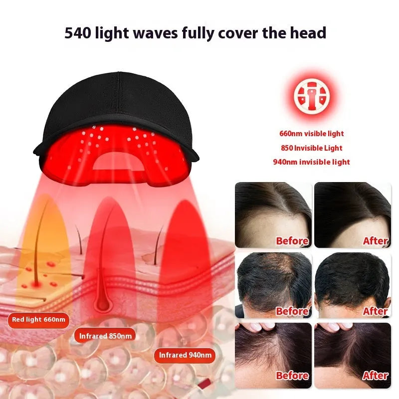Black duckbill-style infrared hair growth cap with LED lights and a separate controller unit.
