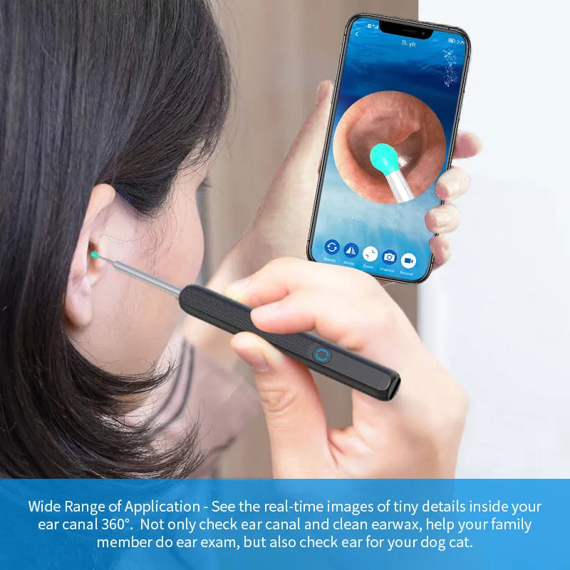 NE3 wireless ear cleaner otoscope with camera, spoon heads, and charging cable on white background