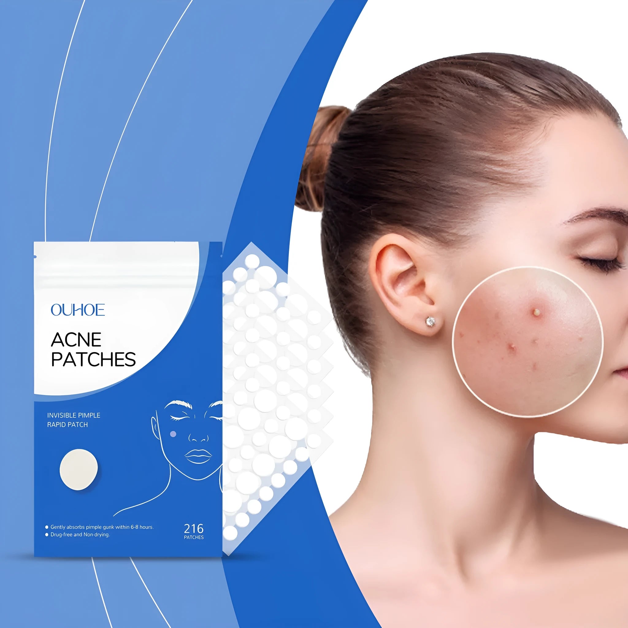 Pack of 216 round hydrocolloid acne patches for facial skincare with tea tree oil and vitamin E.