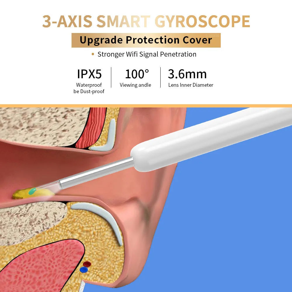 NE3 wireless ear cleaner otoscope with camera, spoon heads, and charging cable on white background