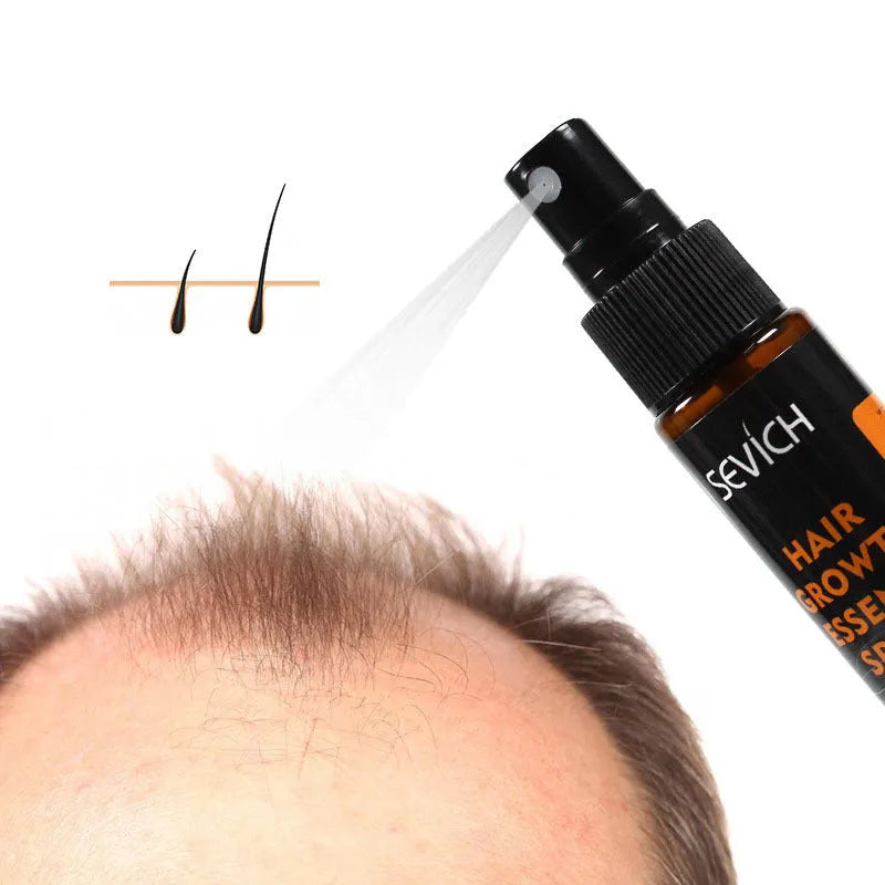 Black anti-drop hair lotion spray 30ml for hair loss prevention and scalp treatment