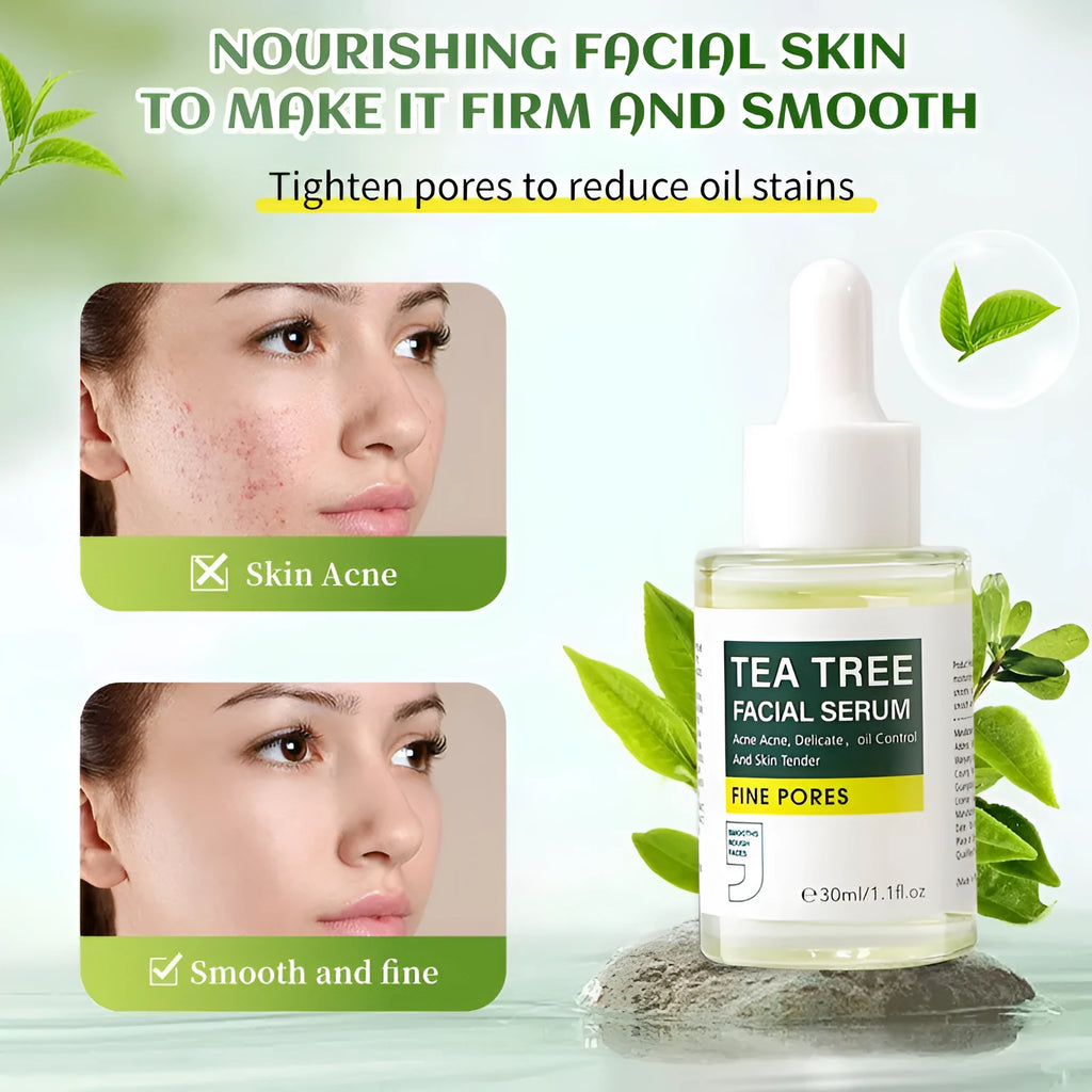 30ml tea tree facial serum in a bottle with a dropper, suitable for neutral oily dry mixed skin types