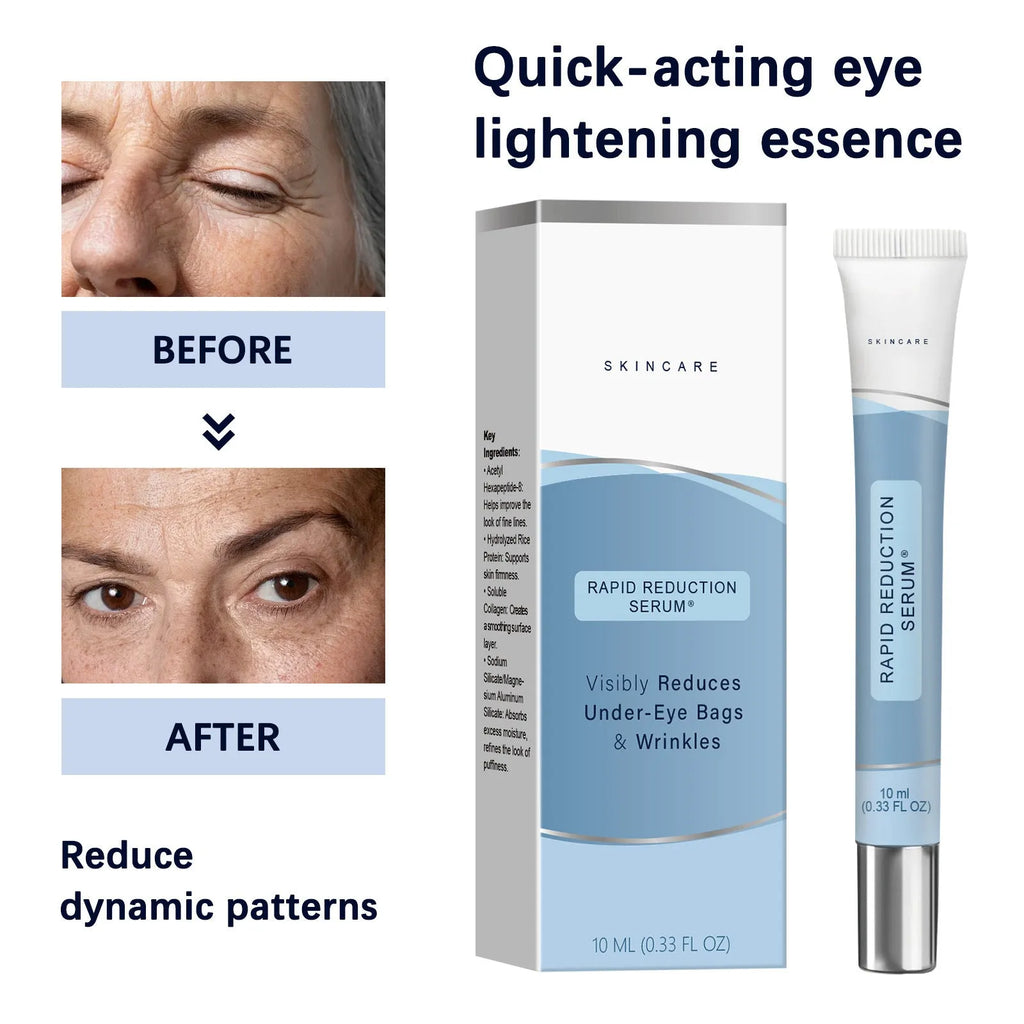15ml Rapid Reduction Eye Serum for eye bags and fine lines, suitable for oily and dry skin