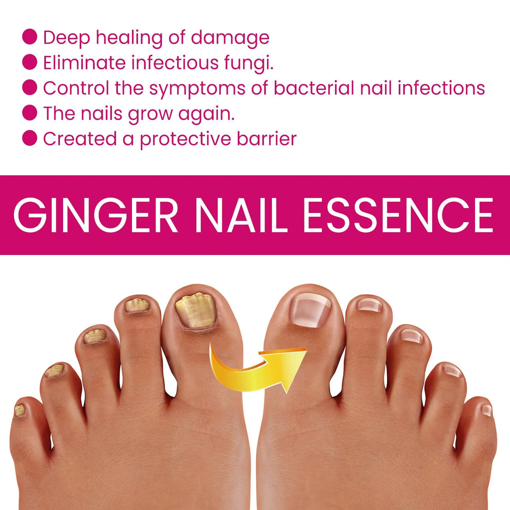 10ml ginger nail care essence bottle with nourishing formula for cuticles and nails