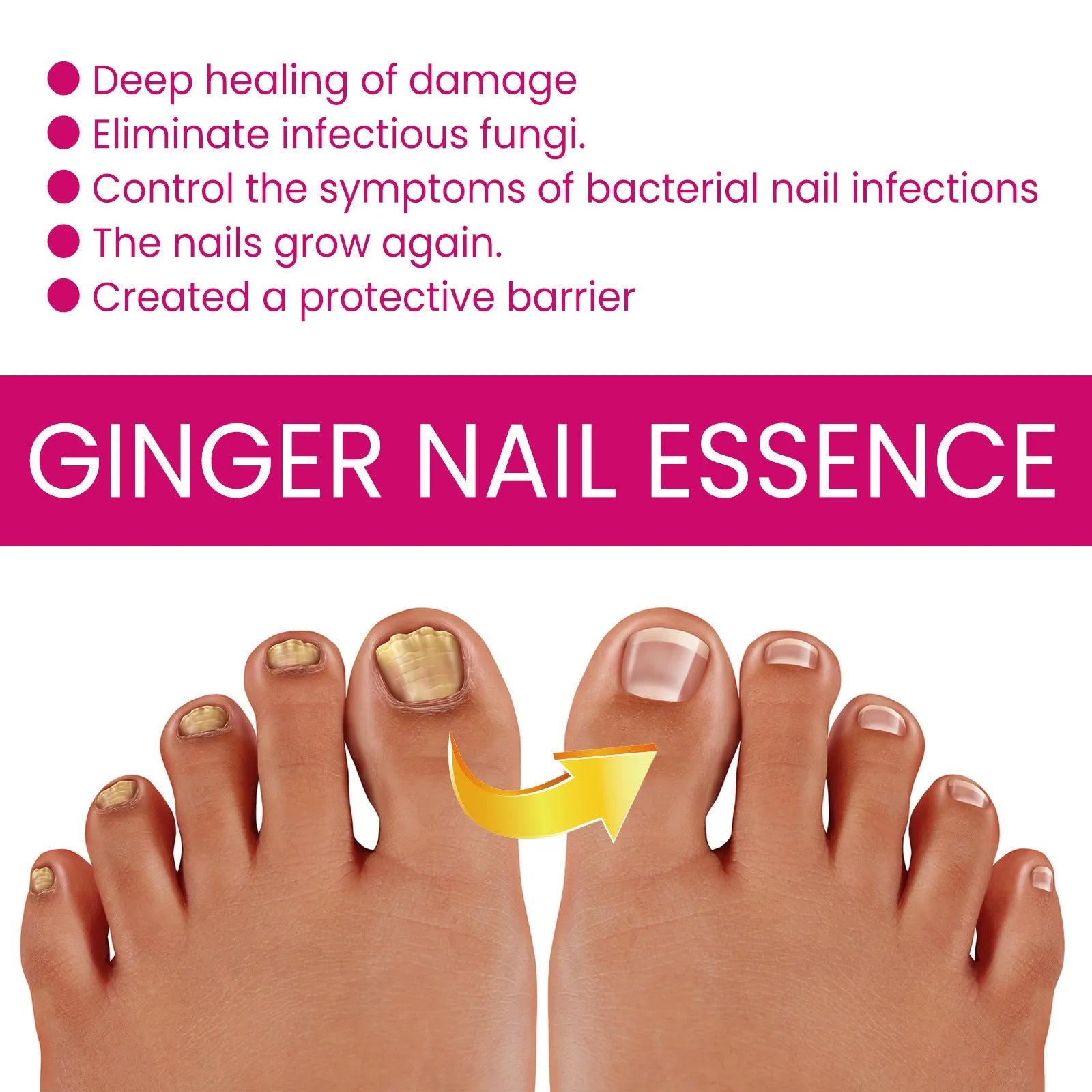 10ml ginger nail care essence bottle with nourishing formula for cuticles and nails