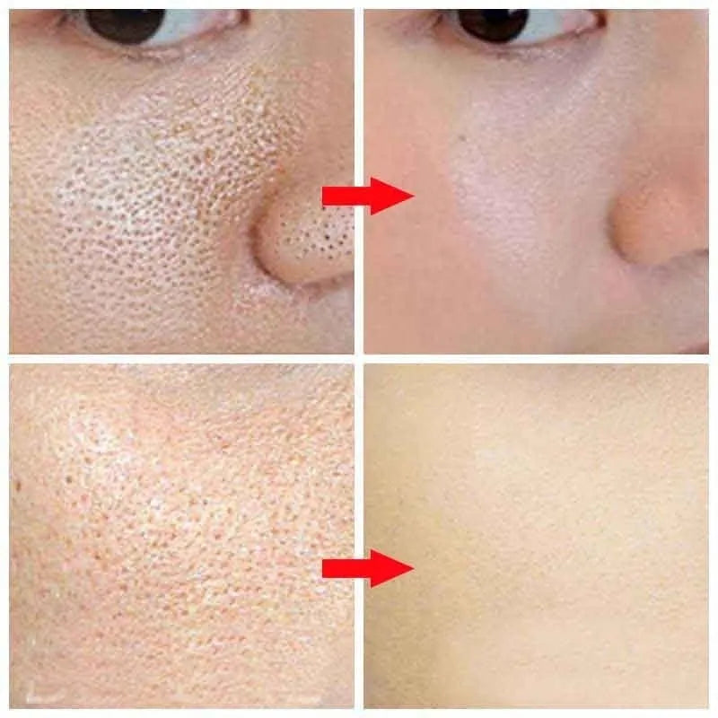 10ml white pore refining serum bottle with hyaluronic acid for daily skincare use
