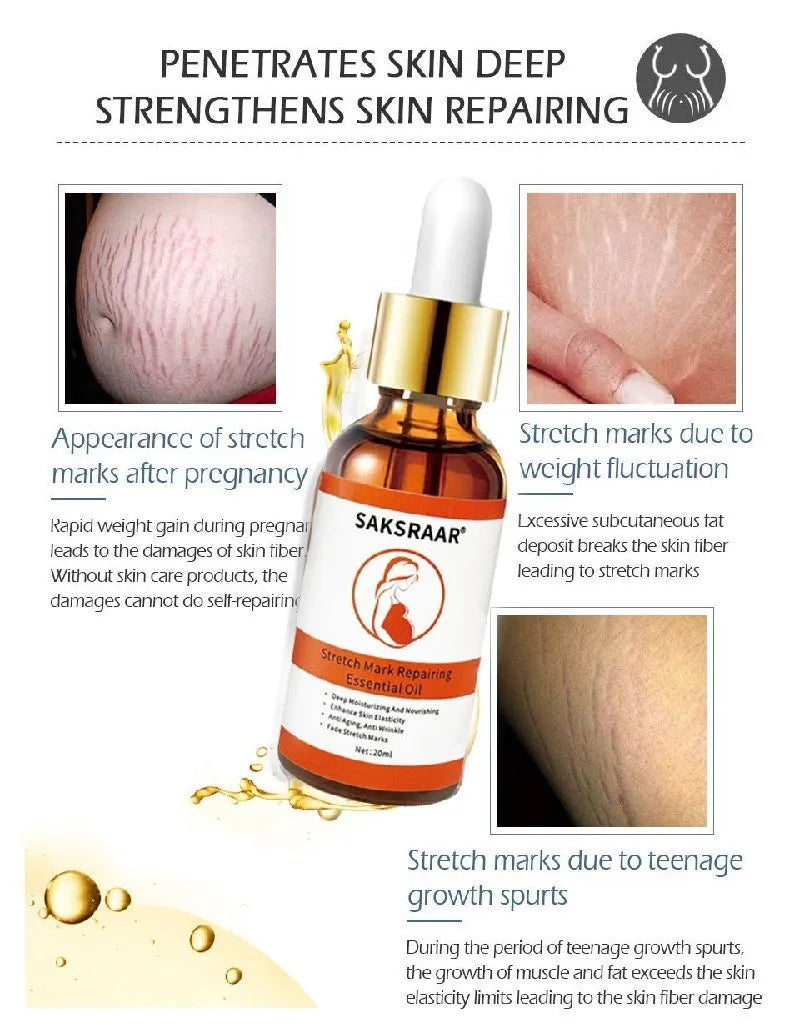 Tea tree stretch mark remover essential oil in 20ml box with colour packaging