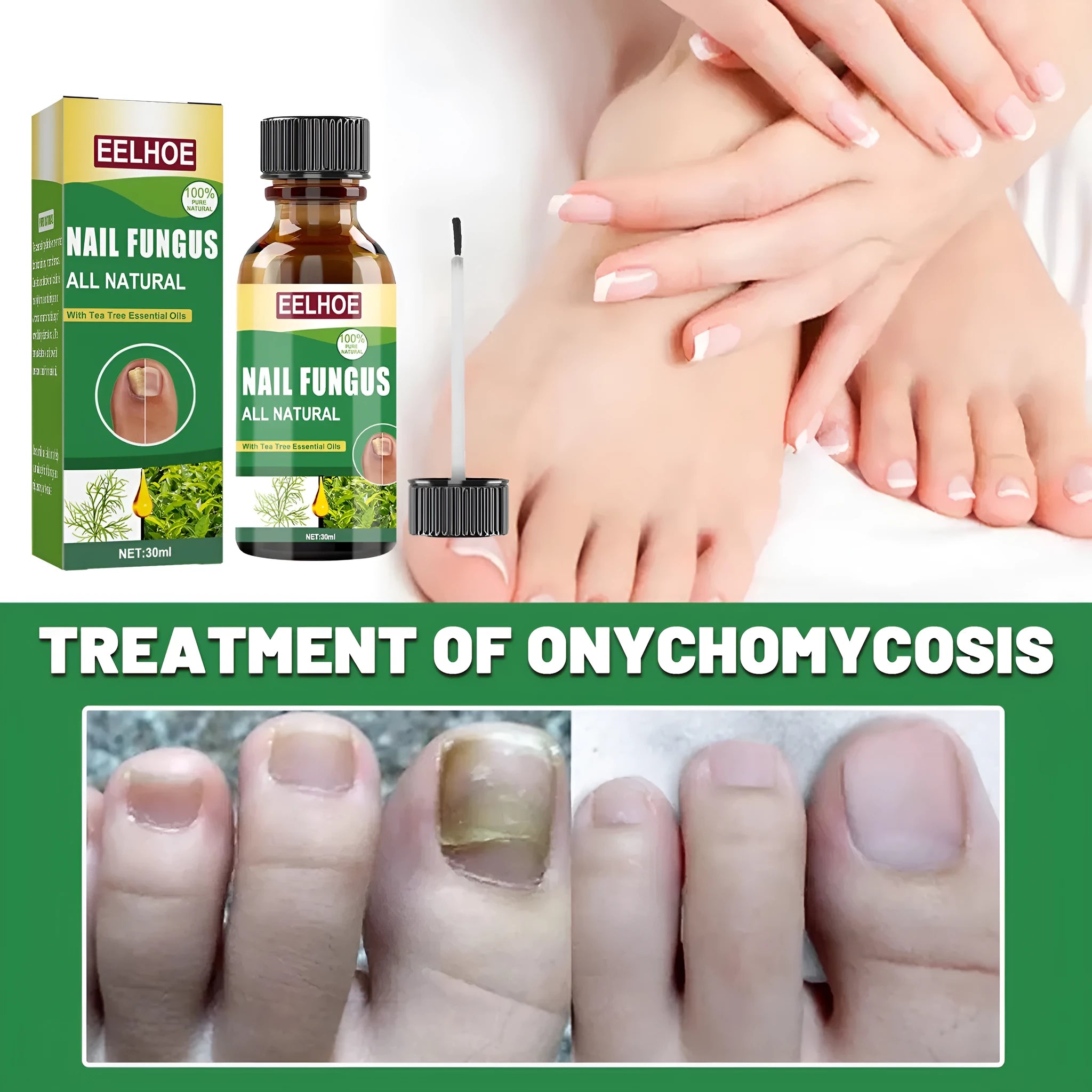 30ml bottle of tea tree oil foot and nail care repair fluid solution
