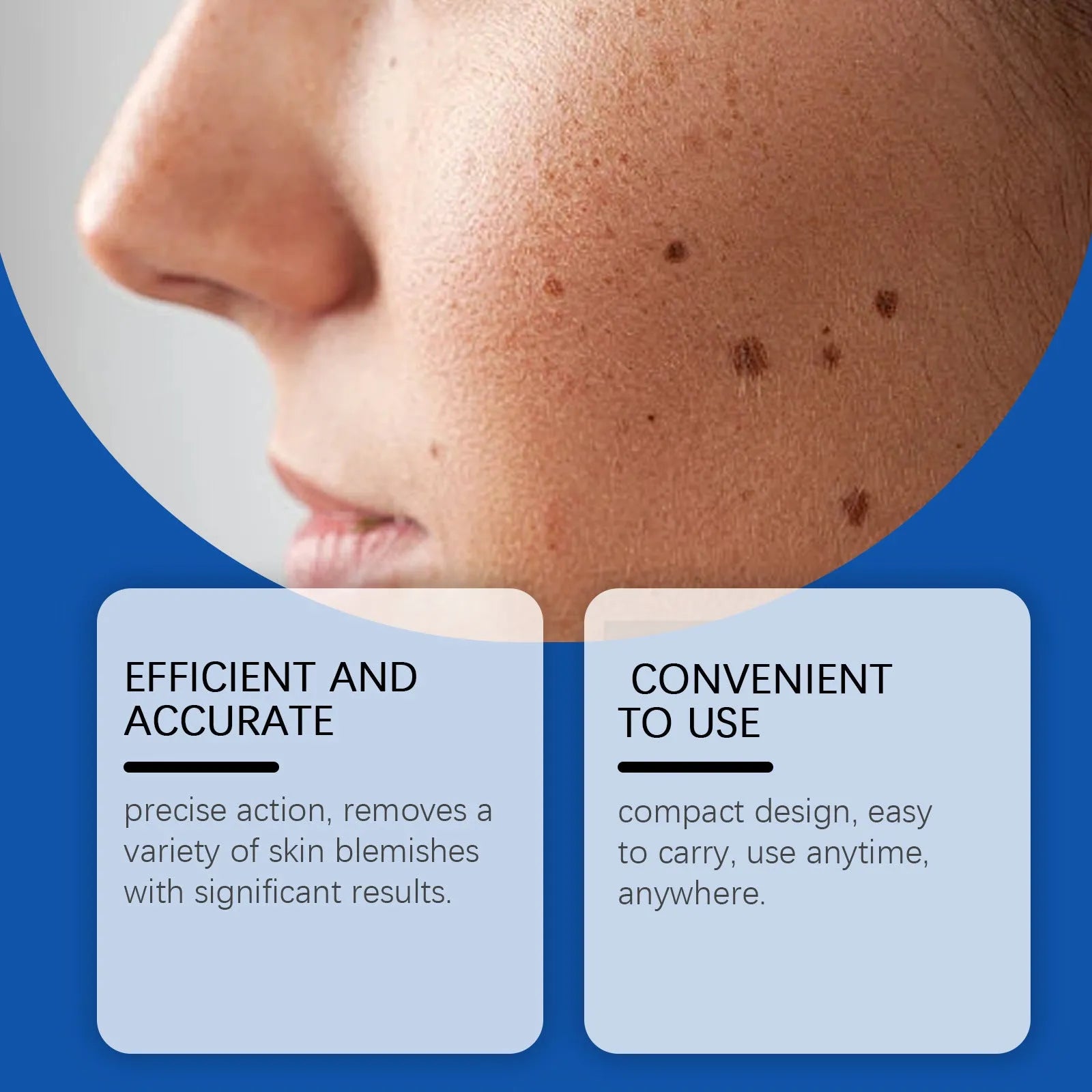Mole wart removal laser pen device with ABS plastic housing for targeted skin treatment