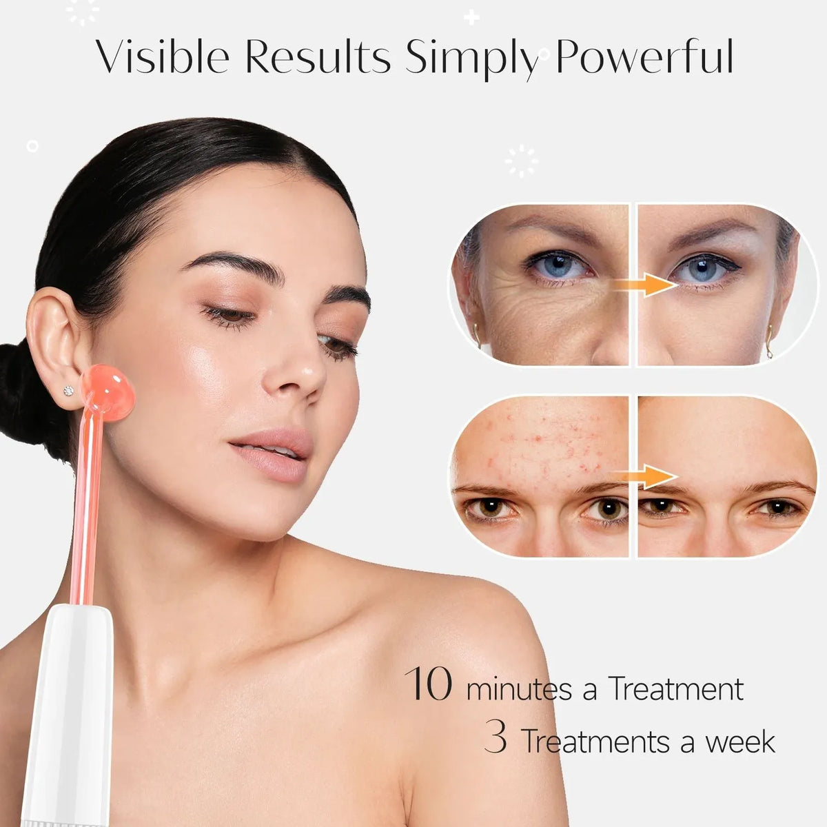 High frequency electrode magic wand machine in blue neon light, space capsule design, with EU plug for acne marks removal