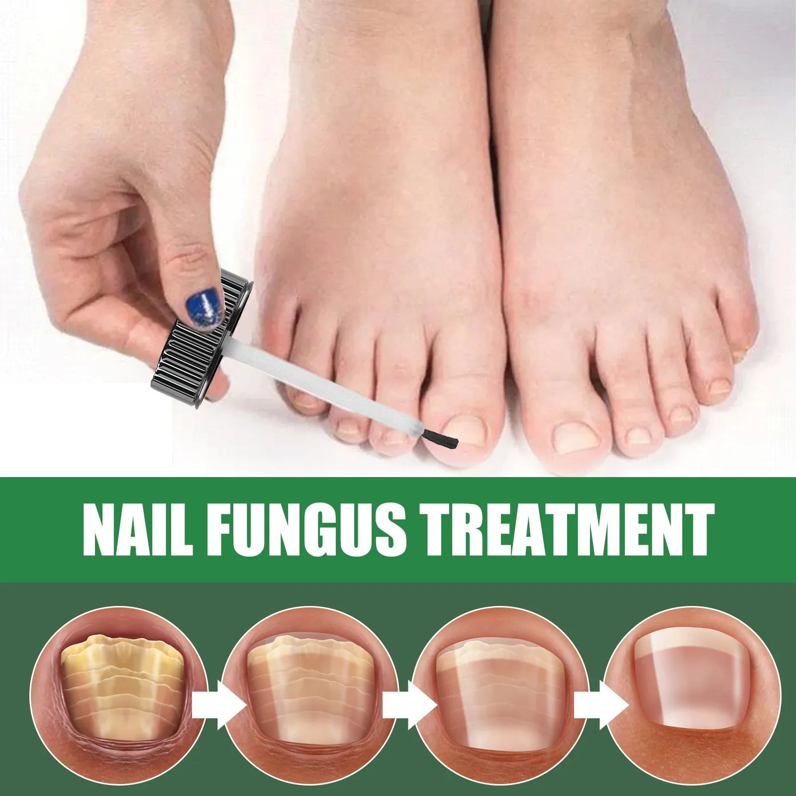 30ml bottle of tea tree oil foot and nail care repair fluid solution