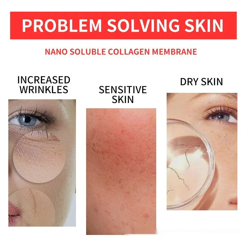 Hydrolyzed Collagen Mask Nano-instant Filling Tablets set with cheek, forehead, and neck patches 28ml