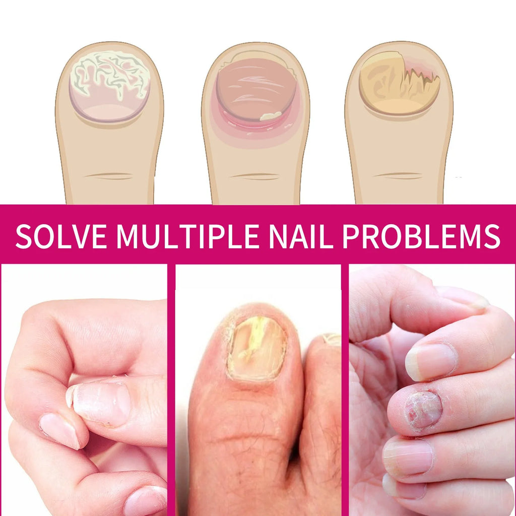 10ml ginger nail care essence bottle with nourishing formula for cuticles and nails
