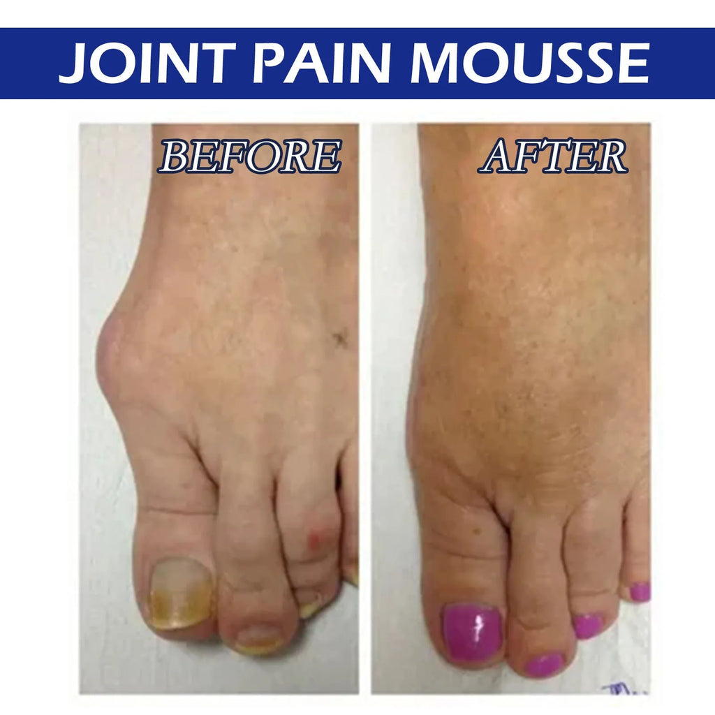 15ml bottle of herbal care drops for soreness and joint relief massage