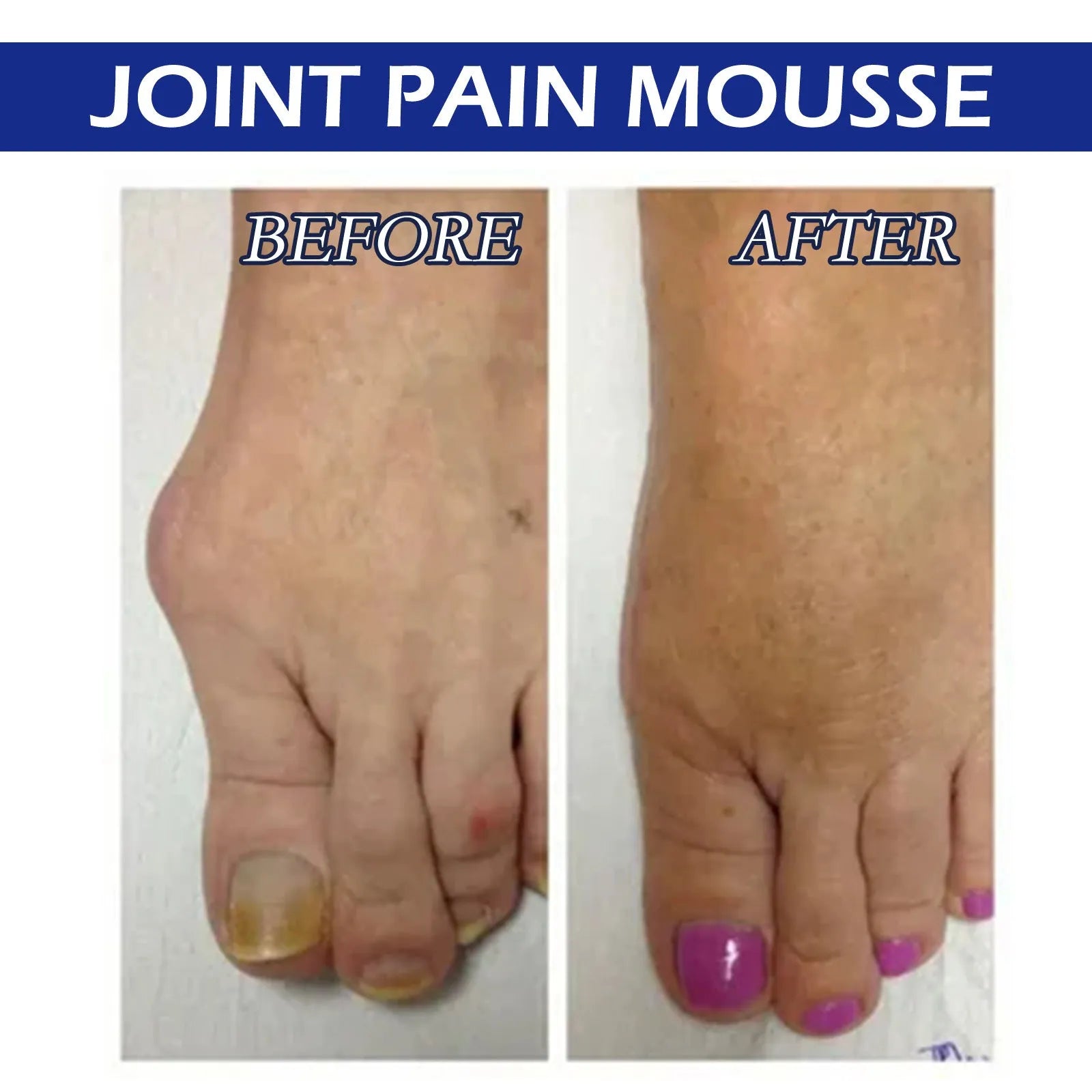 15ml bottle of herbal care drops for soreness and joint relief massage