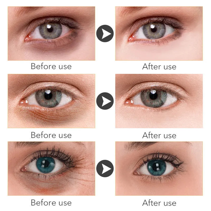 Beauty Eye Cream in a 30ml container for women's skin care.