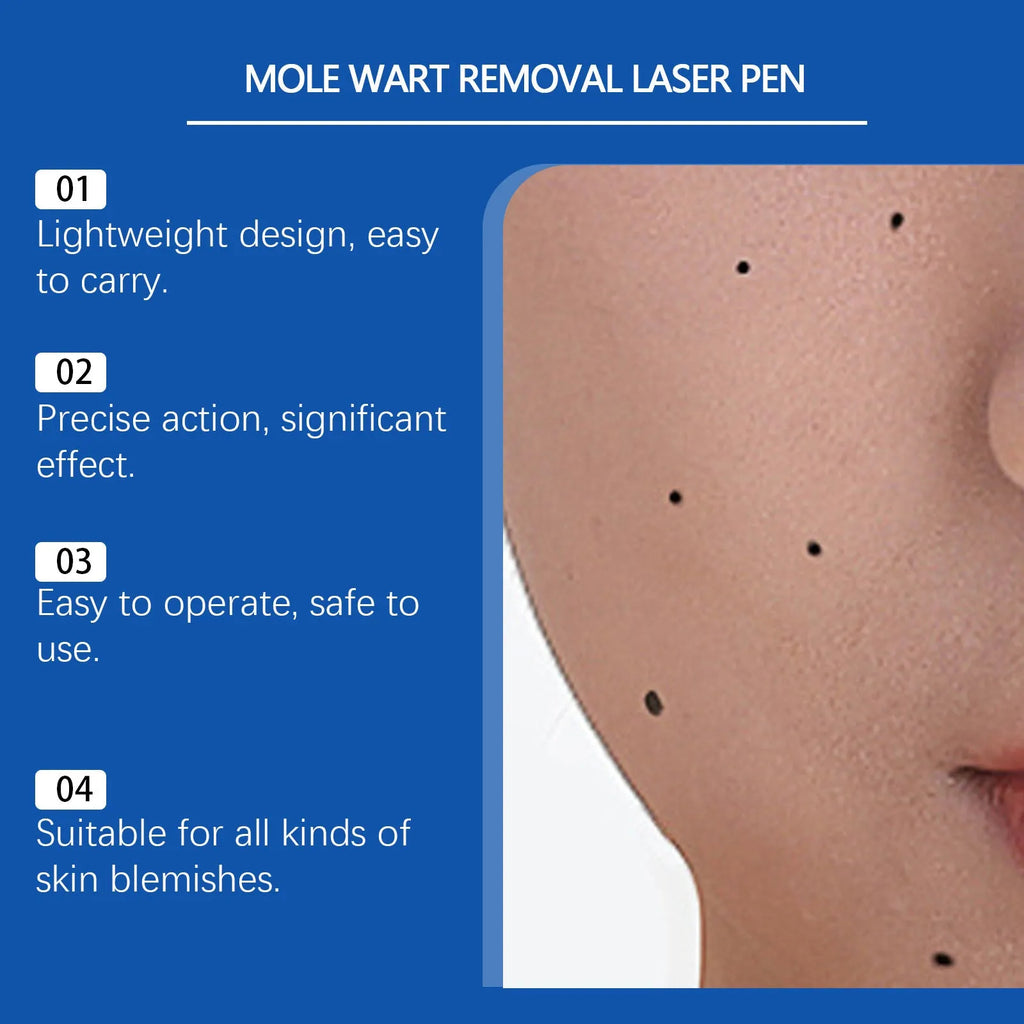 Mole wart removal laser pen device with ABS plastic housing for targeted skin treatment