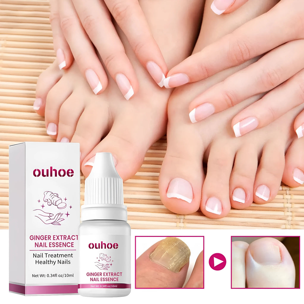 10ml ginger nail care essence bottle with nourishing formula for cuticles and nails