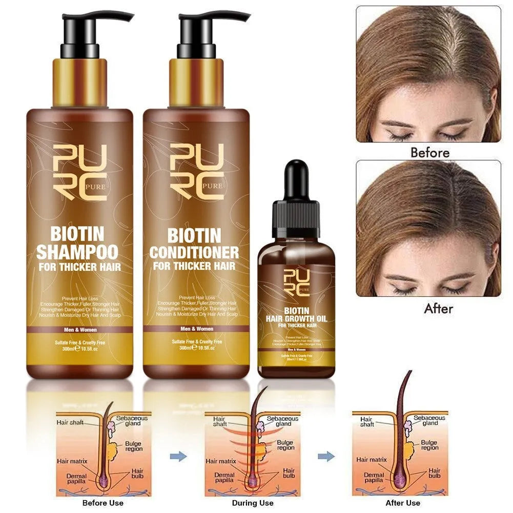 Ginger biotin hair care set with 300ml shampoo, 300ml conditioner and 30ml biotin essential oil