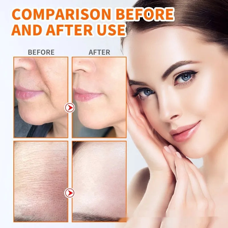 Hydrolyzed Collagen Mask Nano-instant Filling Tablets set with cheek, forehead, and neck patches 28ml