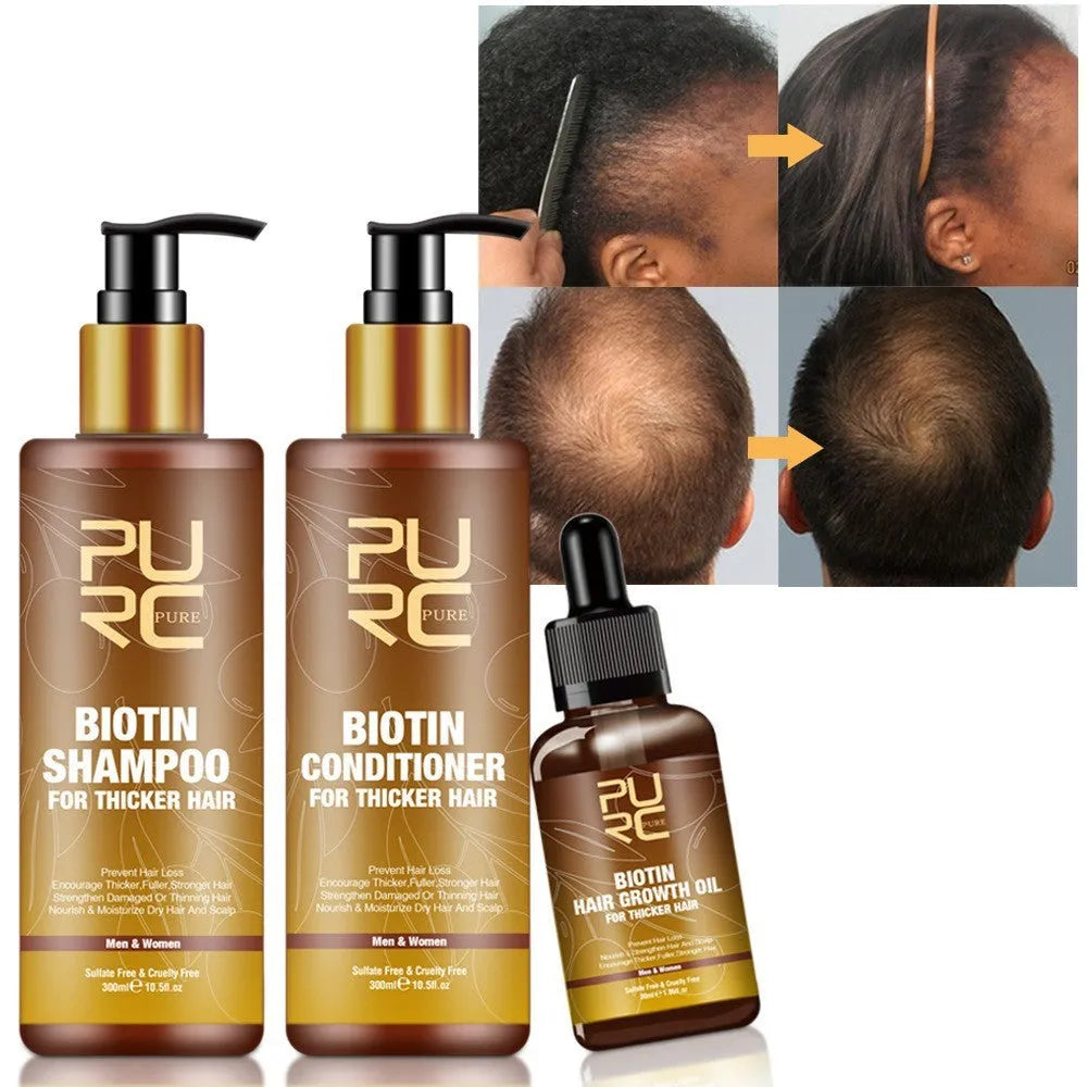 Ginger biotin hair care set with 300ml shampoo, 300ml conditioner and 30ml biotin essential oil