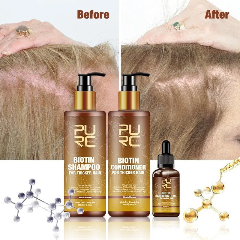 Ginger biotin hair care set with 300ml shampoo, 300ml conditioner and 30ml biotin essential oil