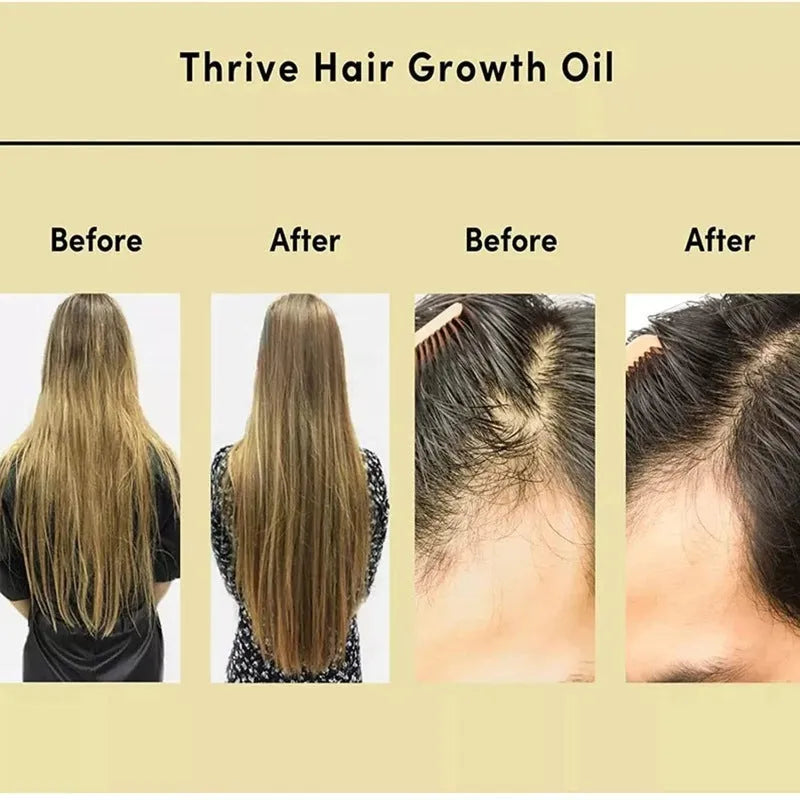 Yellow rosemary hair essential oil in 60ml bottle for damaged hair treatment