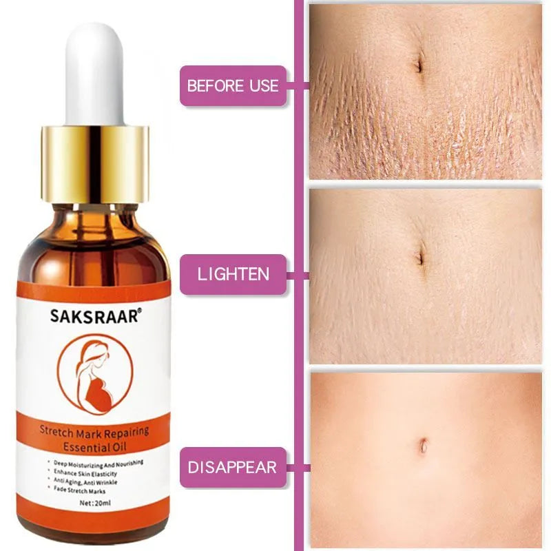 Tea tree stretch mark remover essential oil in 20ml box with colour packaging