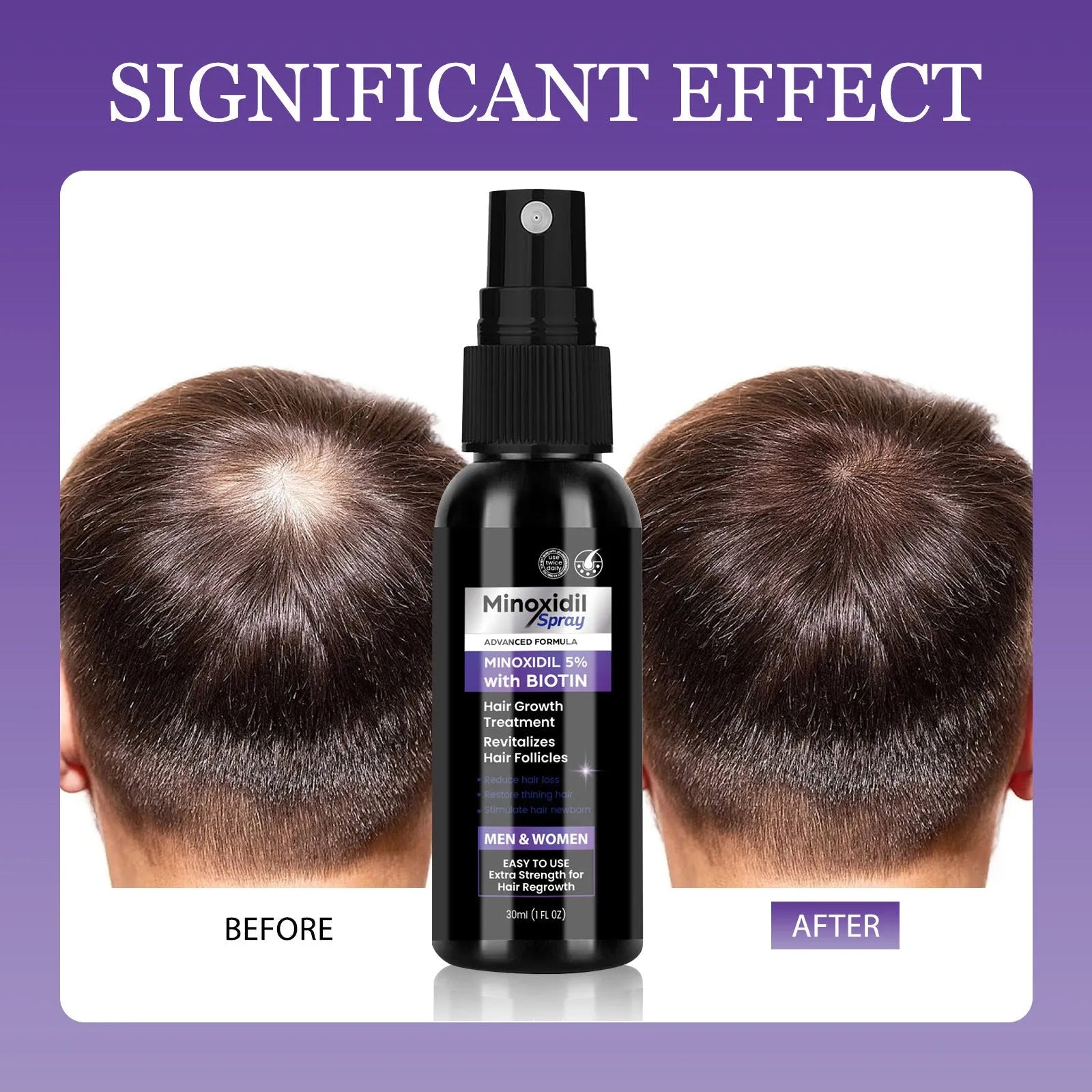 Mino Hair Care Nourishing Hair Supple Scalp Care 30ml hair fixing spray twin pack