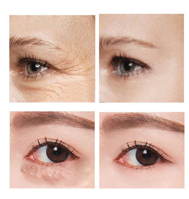 Beauty Eye Cream in a 30ml container for women's skin care.