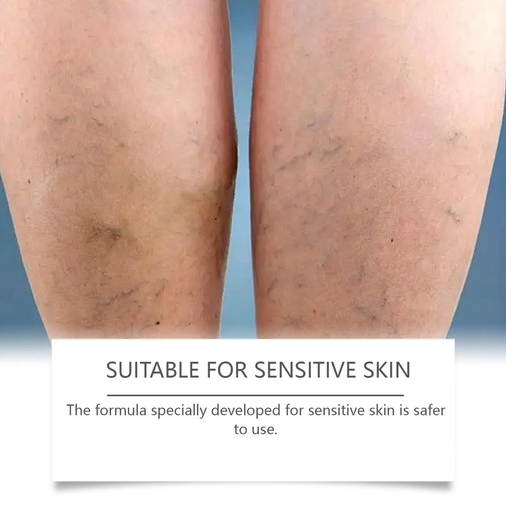 20g tube of leg massage cream containing mint leaves, arnica, witch hazel, vitamin B6 and aloe leaves
