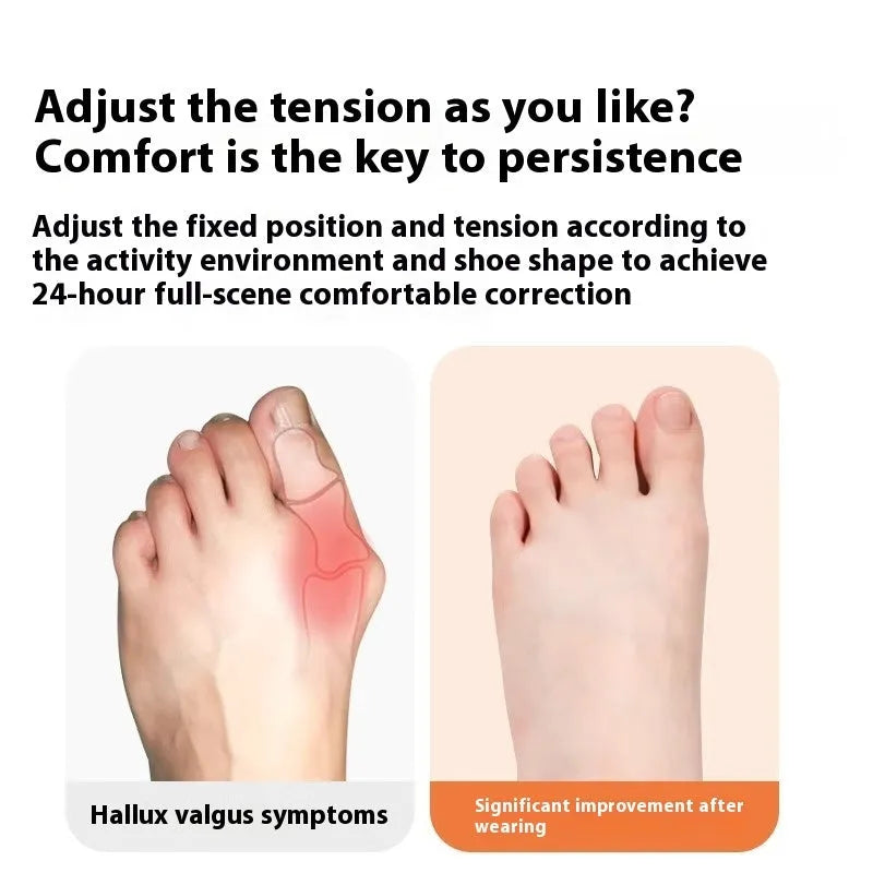 Pre-slitting hallux valgus brace elastic support PVC muscle paste in blue worn inside a shoe
