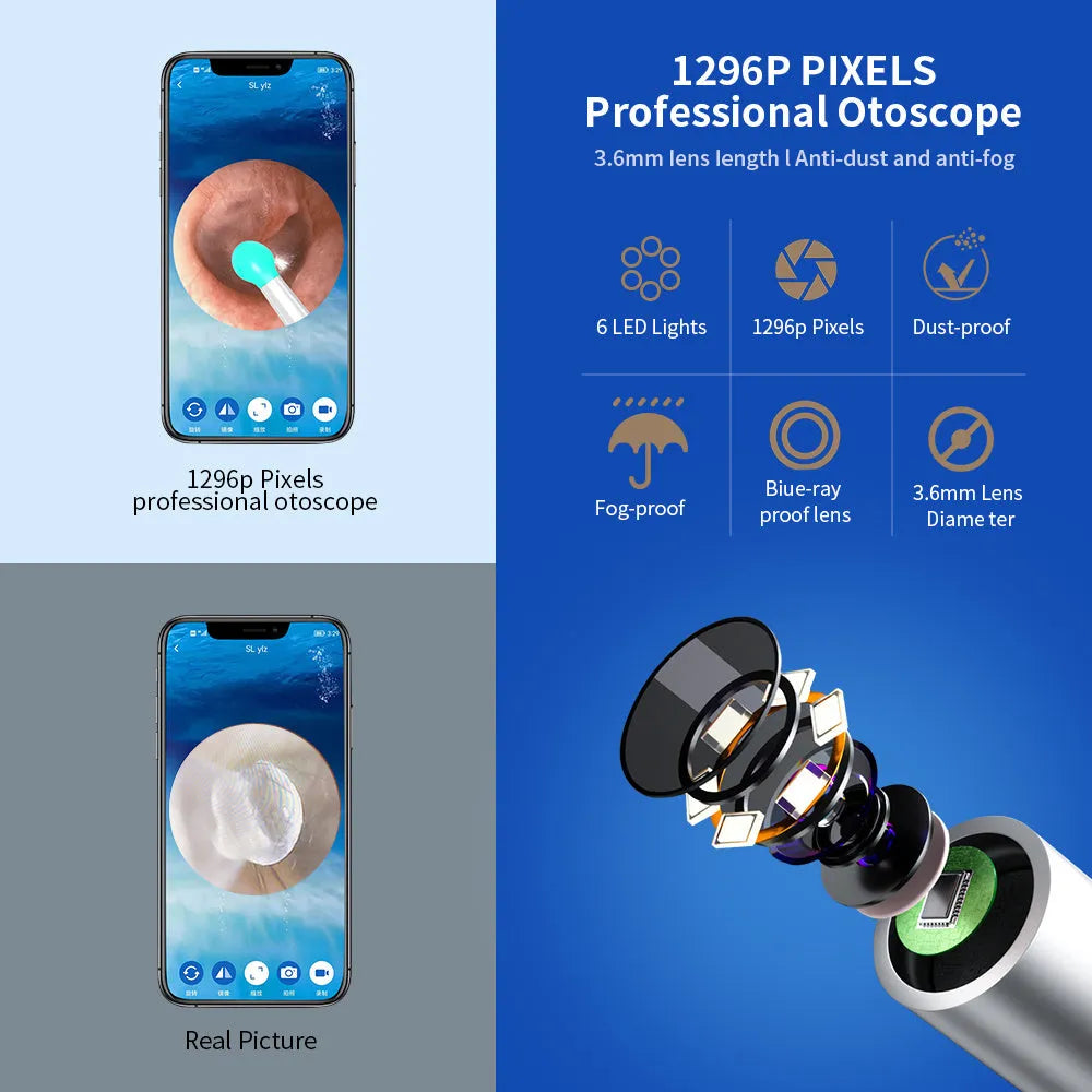 NE3 wireless ear cleaner otoscope with camera, spoon heads, and charging cable on white background
